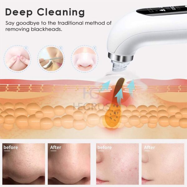 Hydra Facial Black & White Head, Remover Acne, Pimple and Wrinkle Remover Pore Cleansing Machine